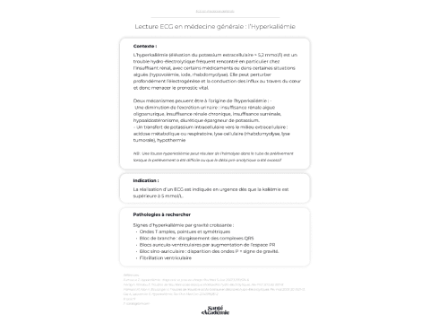 Outil ECG