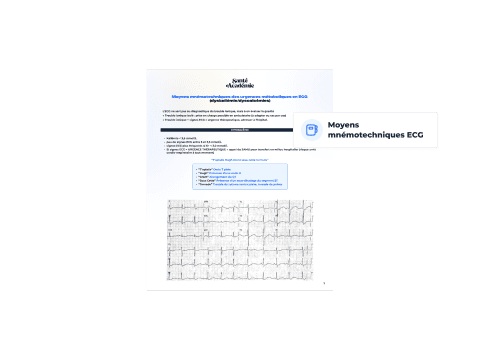 Moyens mnémotechniques pour l'ECG