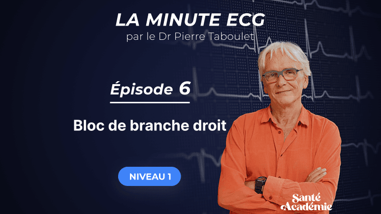La minute ECG