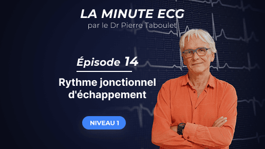 La minute ECG