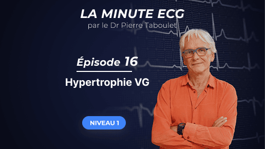La minute ECG